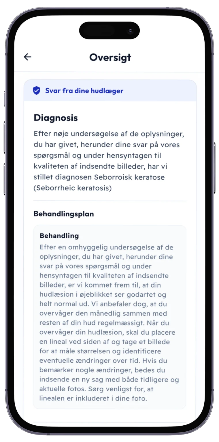 SKIND-appen viser hudlægens diagnose og behandlingsplan
