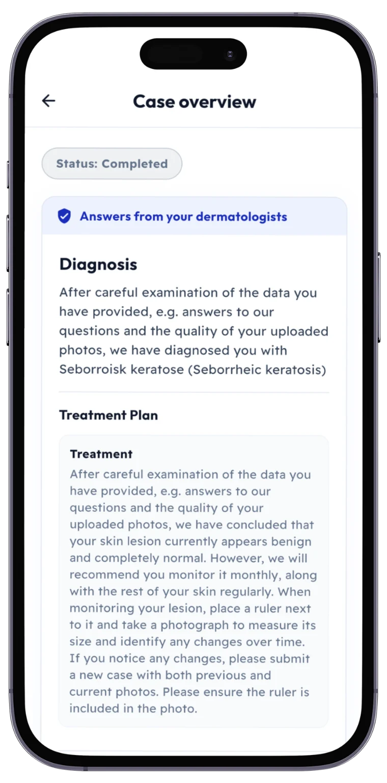The SKIND app showing the dermatologist's diagnosis and treatment plan